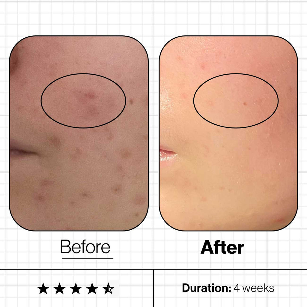 Advanced Nutrition Programme Skin Clear Biome
