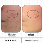 Advanced Nutrition Programme Skin Clear Biome
