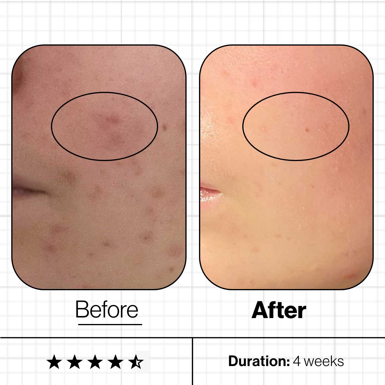 Advanced Nutrition Programme Skin Clear Biome