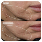 VOL.U.LIFT™ 4D Skin Rebound Complex