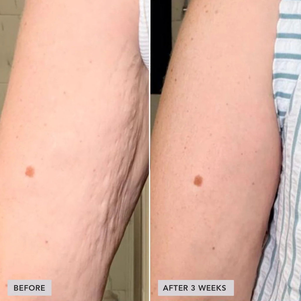 Vol.U.Lift Body - Sculpt + Firm Treatment Complex