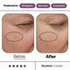Skin Ultimate image 4